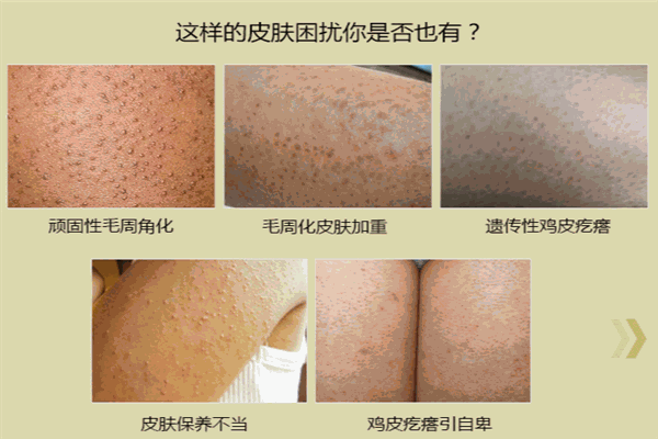康御肤护肤品