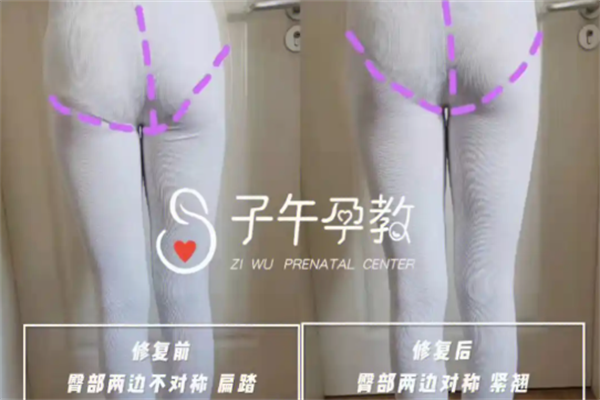产后修复加盟十大品牌连锁店都有哪些