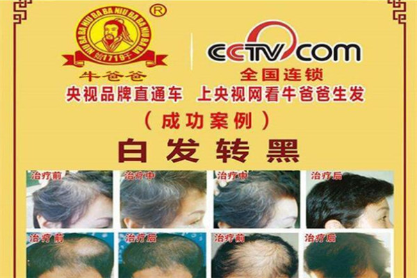 牛爸爸植物养发堂加盟