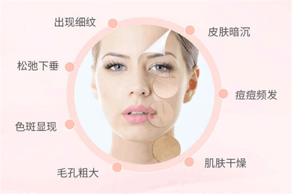 奥美祛痘中心加盟