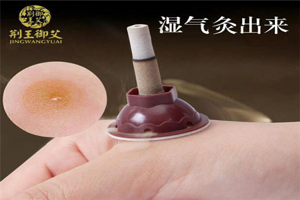 荆王御艾艾灸养生