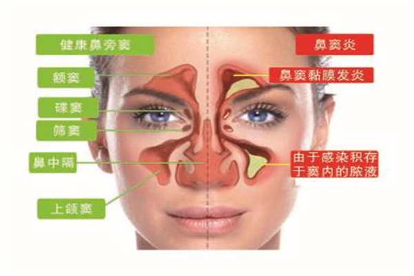 清鼻堂鼻炎馆加盟