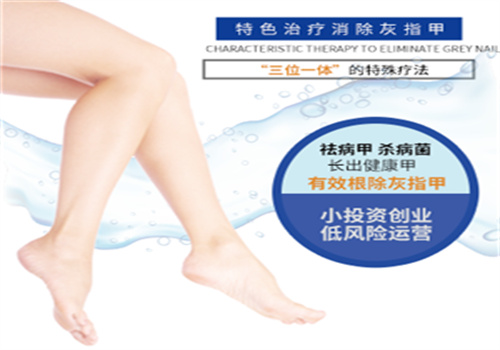 蕙乐百灵加盟