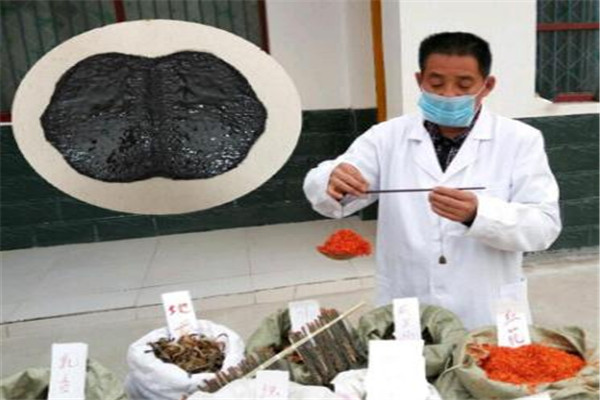 椎风益土家土方黑膏药