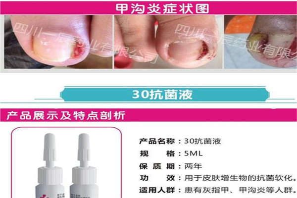 一手一足灰指甲脚气