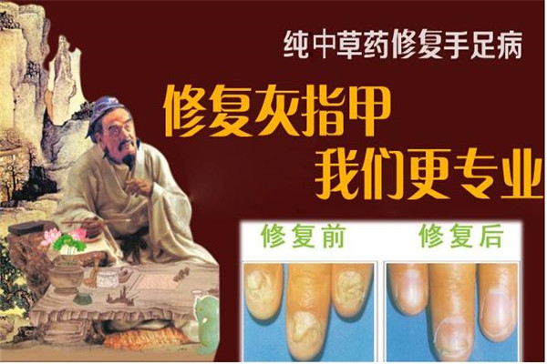 田氏甲肤康灰指甲加盟