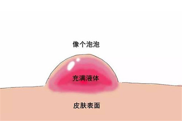 蒯大夫烧烫伤诊所加盟