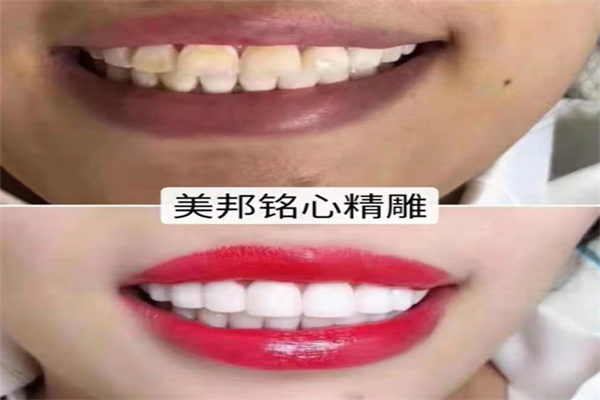 美邦铭心精雕