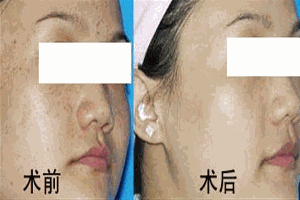 豆蔻九九