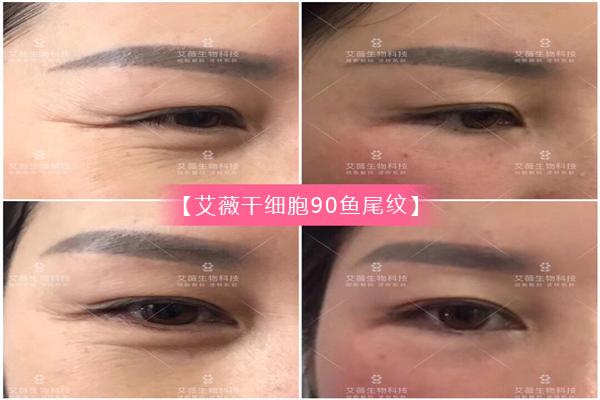 艾薇干细胞