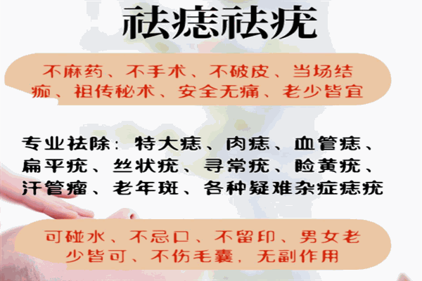 痣运星