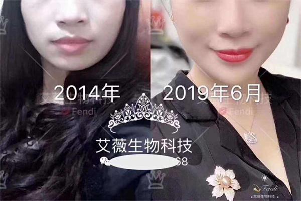 艾薇干细胞