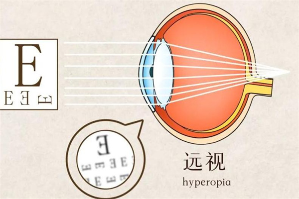 怀柔眼视力加盟