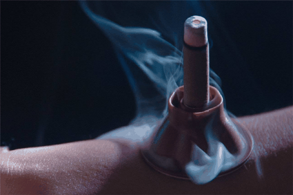 梵德艾灸