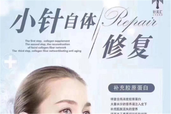 欧邦针美汇加盟