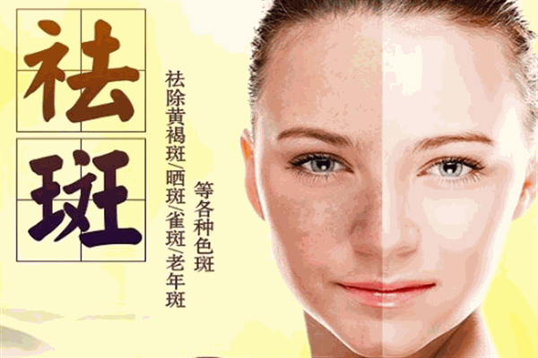 俏姿态祛斑