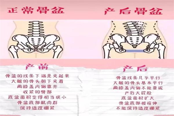 芊诺尔产后修复