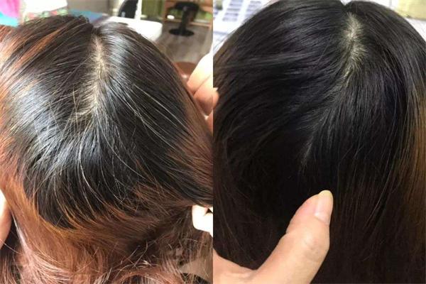 黑桃a白发转黑发