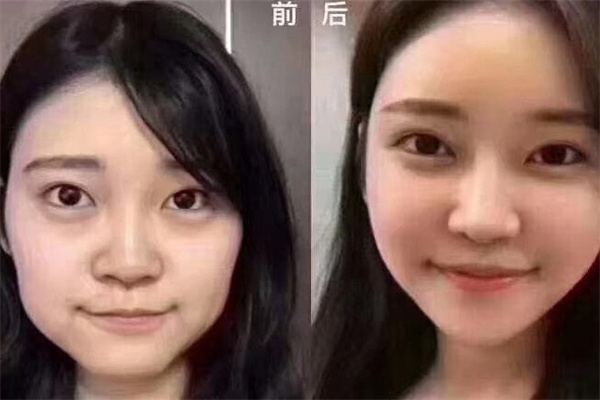 蔻瑞莎干细胞