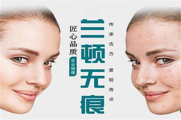 兰顿除疤加盟
