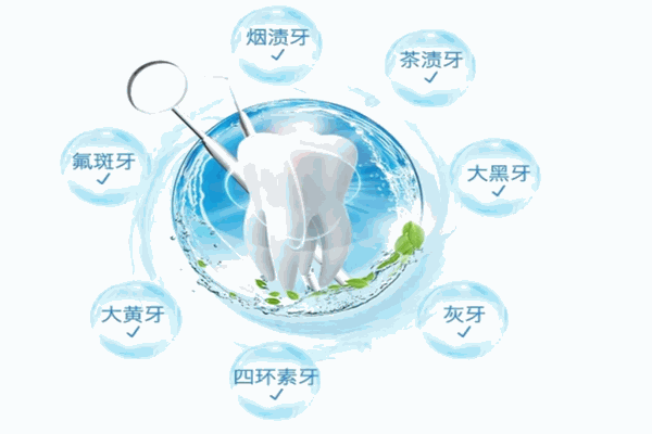 香港睿狮莱牙齿美白产品