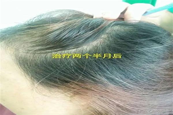 博士园植发