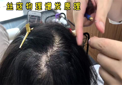 丝寇增发