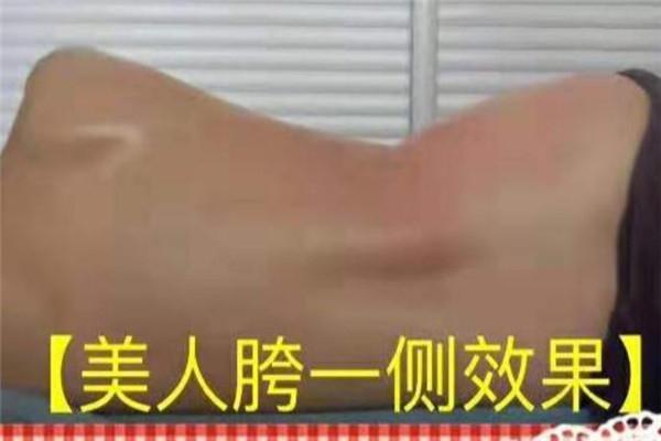 龙骨罐减肥
