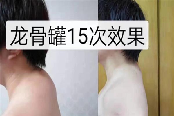 龙骨罐减肥