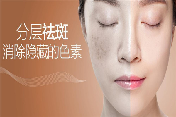 忆美时光祛斑加盟
