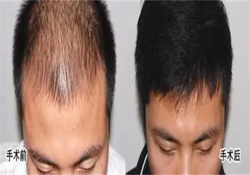 丽碧斯轻增发