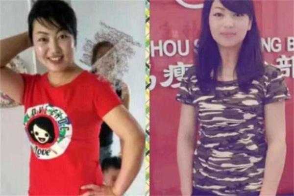 绣瑞斯减肥