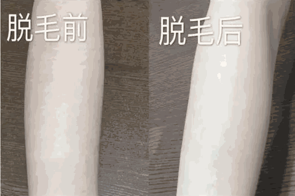 每怡脱毛加盟