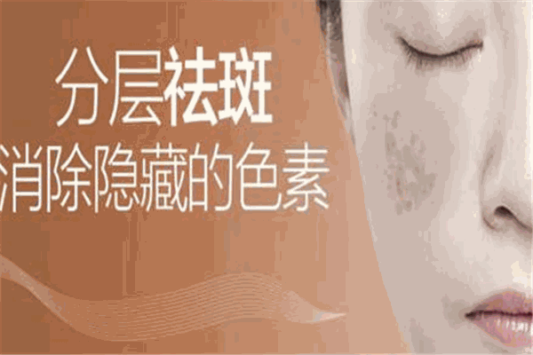泽凯秀祛斑