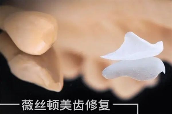 薇丝顿牙齿美白加盟