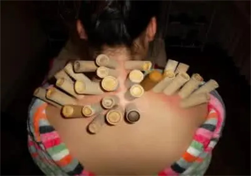 吃饱瘦竹罐减肥