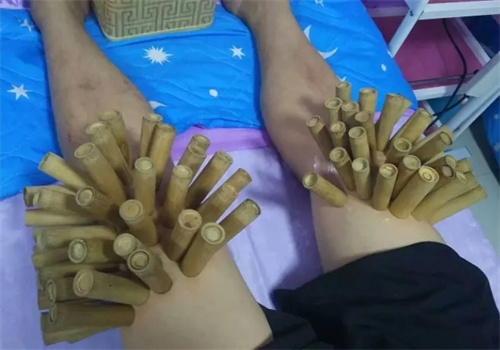 吃饱瘦竹罐减肥