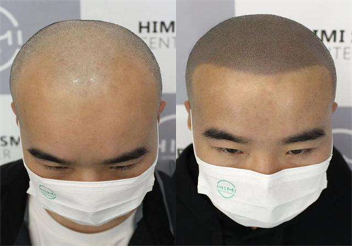 黑米3d纹发