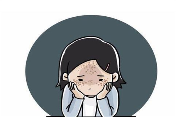 澳蜜莱祛斑