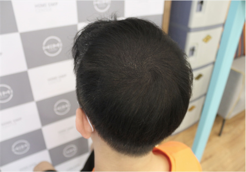 黑米3d纹发