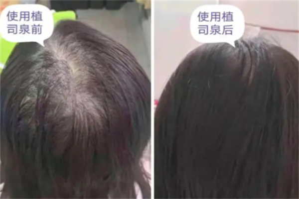 植司泉养发馆