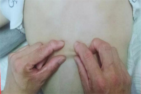 菲常管家小儿推拿加盟