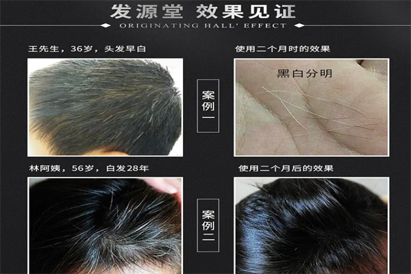 发源堂白发转黑发