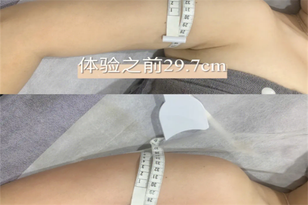 悦美瘦减肥加盟