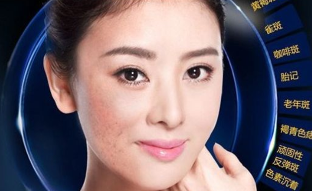 媄妋泉祛斑