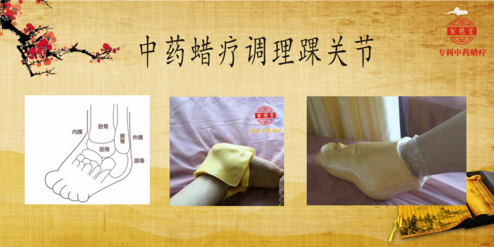 岳家草堂中药蜡疗