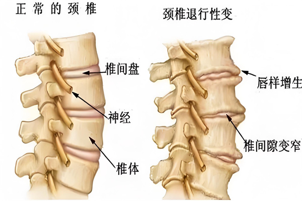 高医堂颈椎腰椎