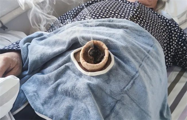 云馨脐灸