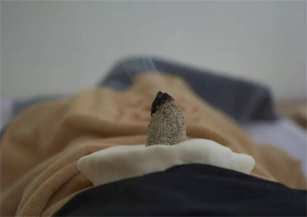 云馨脐灸