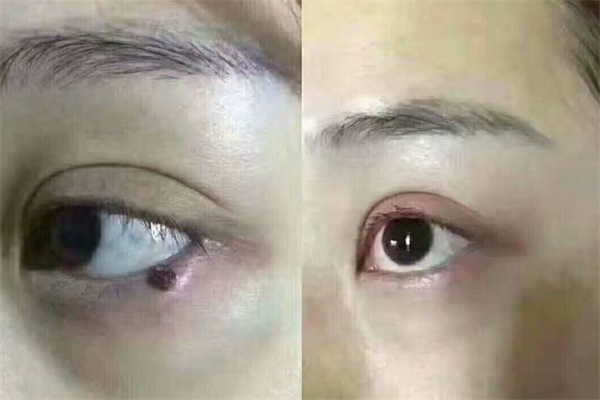 痣缘堂
